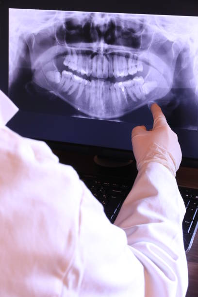 Best Emergency Root Canal Treatment in South Vacherie, LA